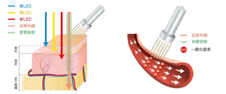 GROTTI PROの仕組み